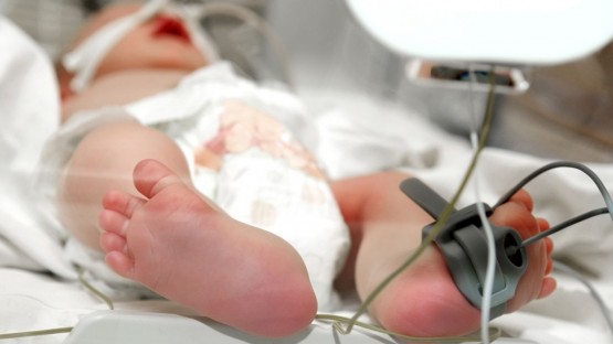 Хирурги РДКБ прооперировали новорожденного с болезнью, встречающейся у одного из 100 тысяч