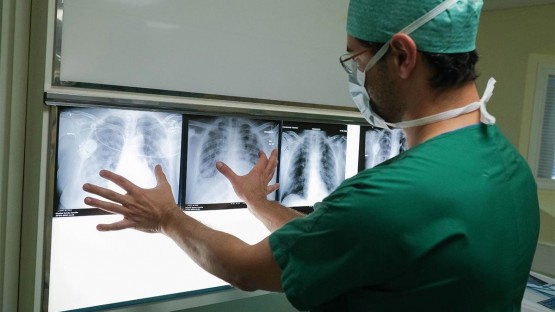 В Северной Осетии наблюдается снижение заболеваемости туберкулезом